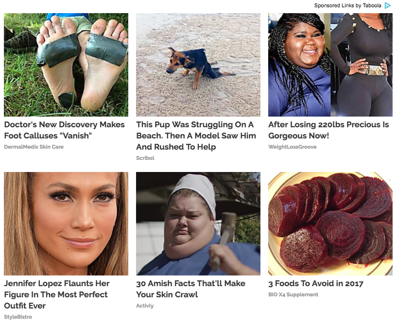 Images of clickbait that demonstrate how very stupid native ad networks think people are.
